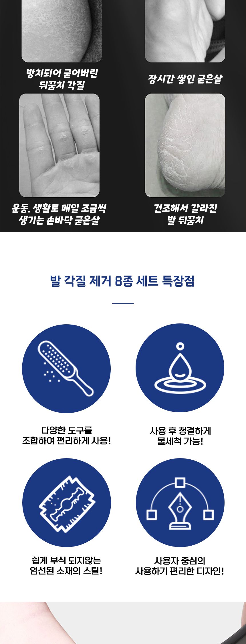 발 각질 제거기 8종 세트/풋파일/각질파일/각질밀이/발밀이/각질제거/굳은살제거/발각질제거/발각질관리/발