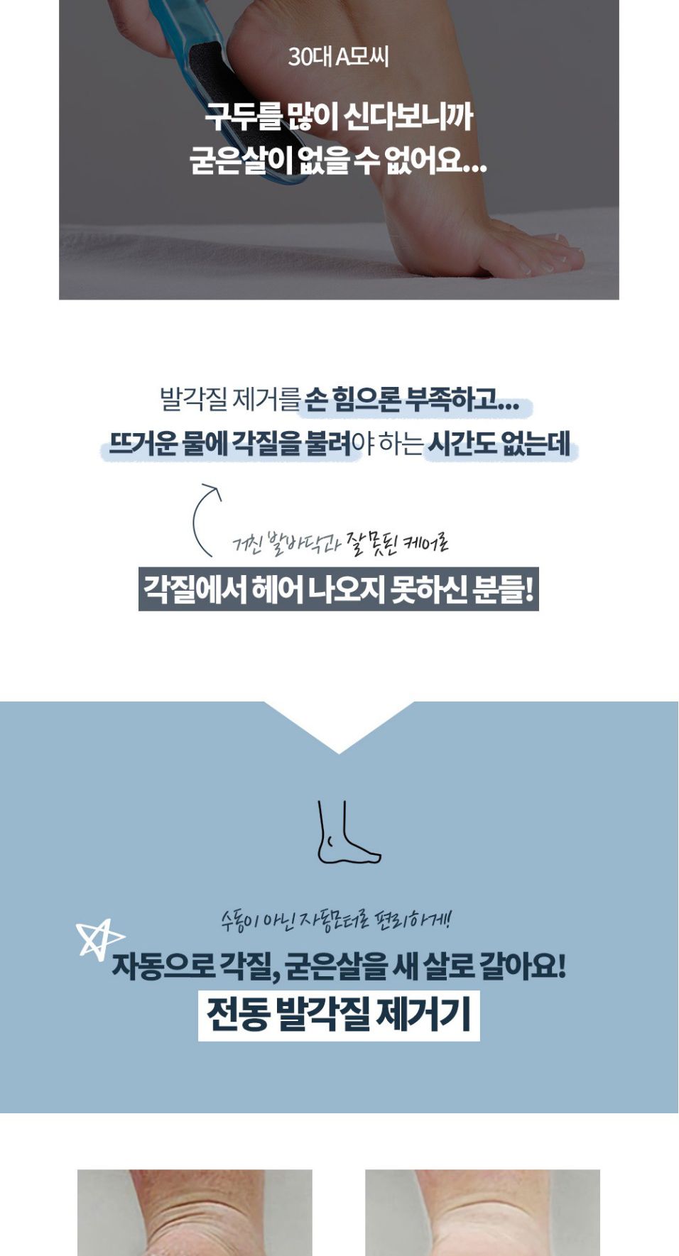전동 발각질 제거기 뒤꿈치 굳은살 관리기 풋케어/발각질제거/발각질제거기/뒷꿈치각질제거/전동발각질제거