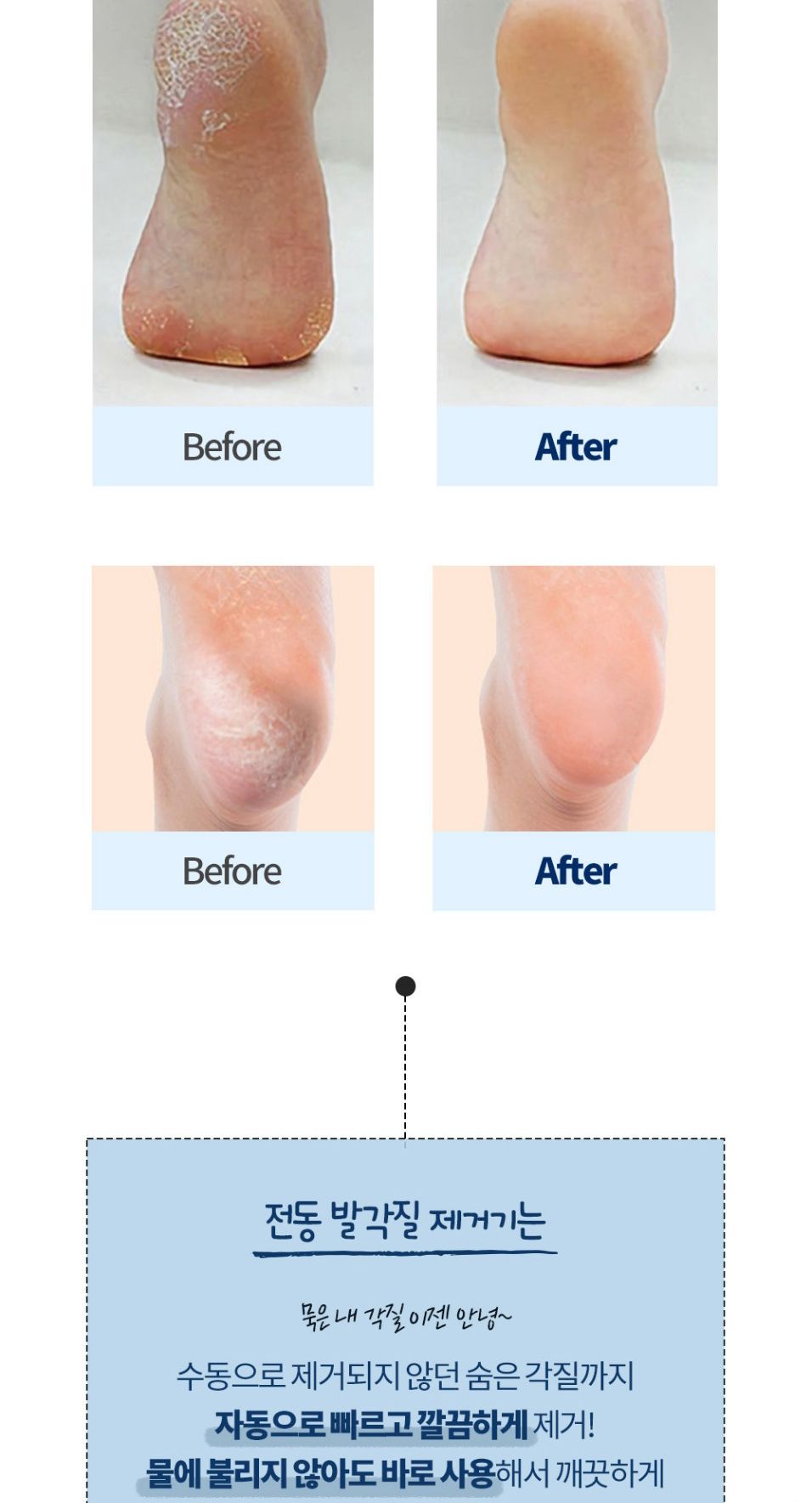 전동 발각질 제거기 뒤꿈치 굳은살 관리기 풋케어/발각질제거/발각질제거기/뒷꿈치각질제거/전동발각질제거