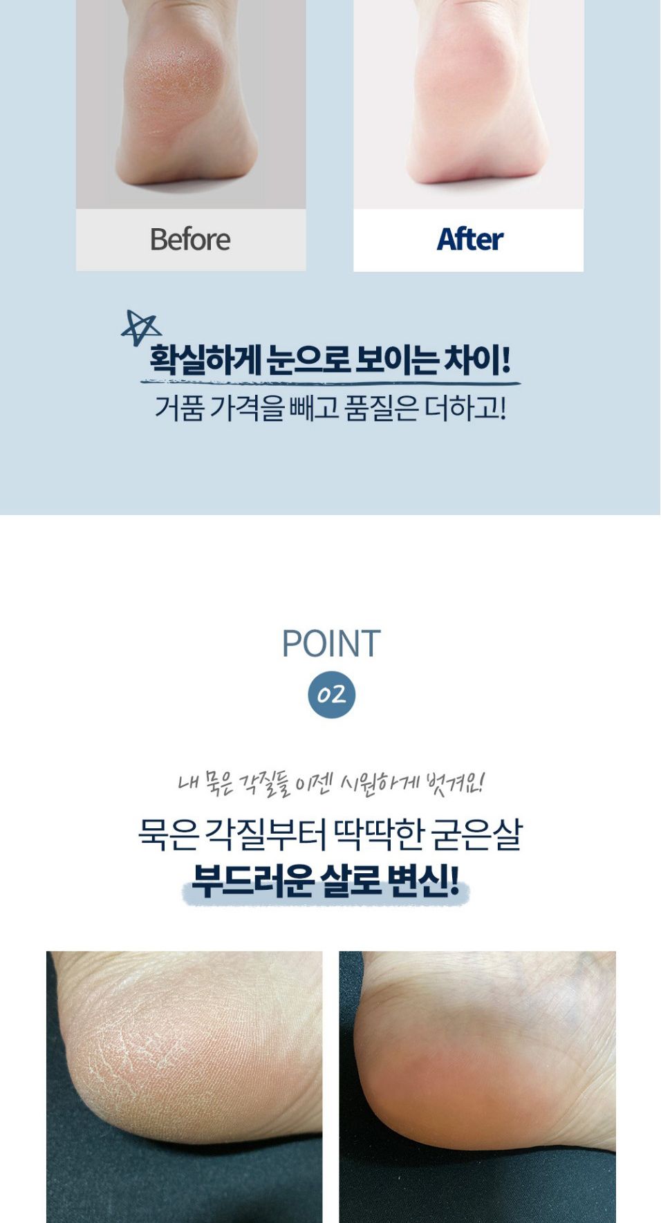 전동 발각질 제거기 뒤꿈치 굳은살 관리기 풋케어/발각질제거/발각질제거기/뒷꿈치각질제거/전동발각질제거