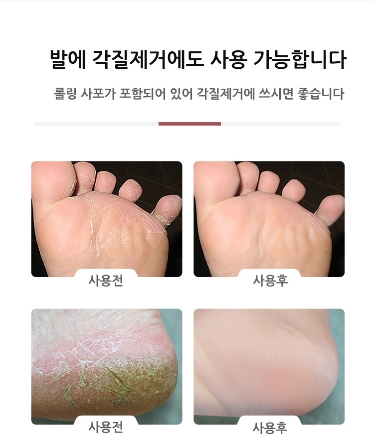 손톱관리 셀프네일드릴 비트 네일도구 전동샤퍼/발톱관리/문제성발톱/전동샤퍼/발톱스케일링/손톱연마기/발