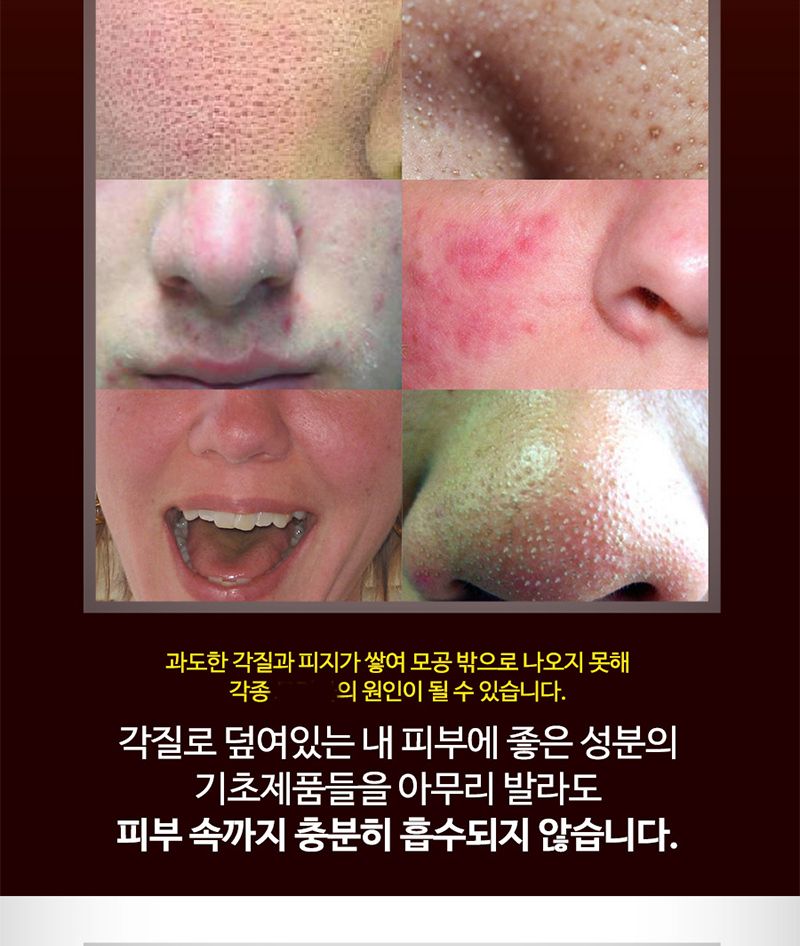 AHA BHA 각질 제거 토너 모공 필링 스킨/로션/여자/대용량/남성/화장품/여성/목욕탕