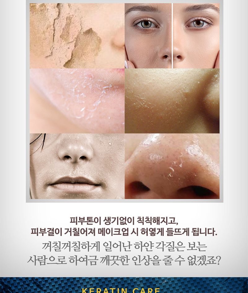 AHA BHA 각질 제거 토너 모공 필링 스킨/로션/여자/대용량/남성/화장품/여성/목욕탕